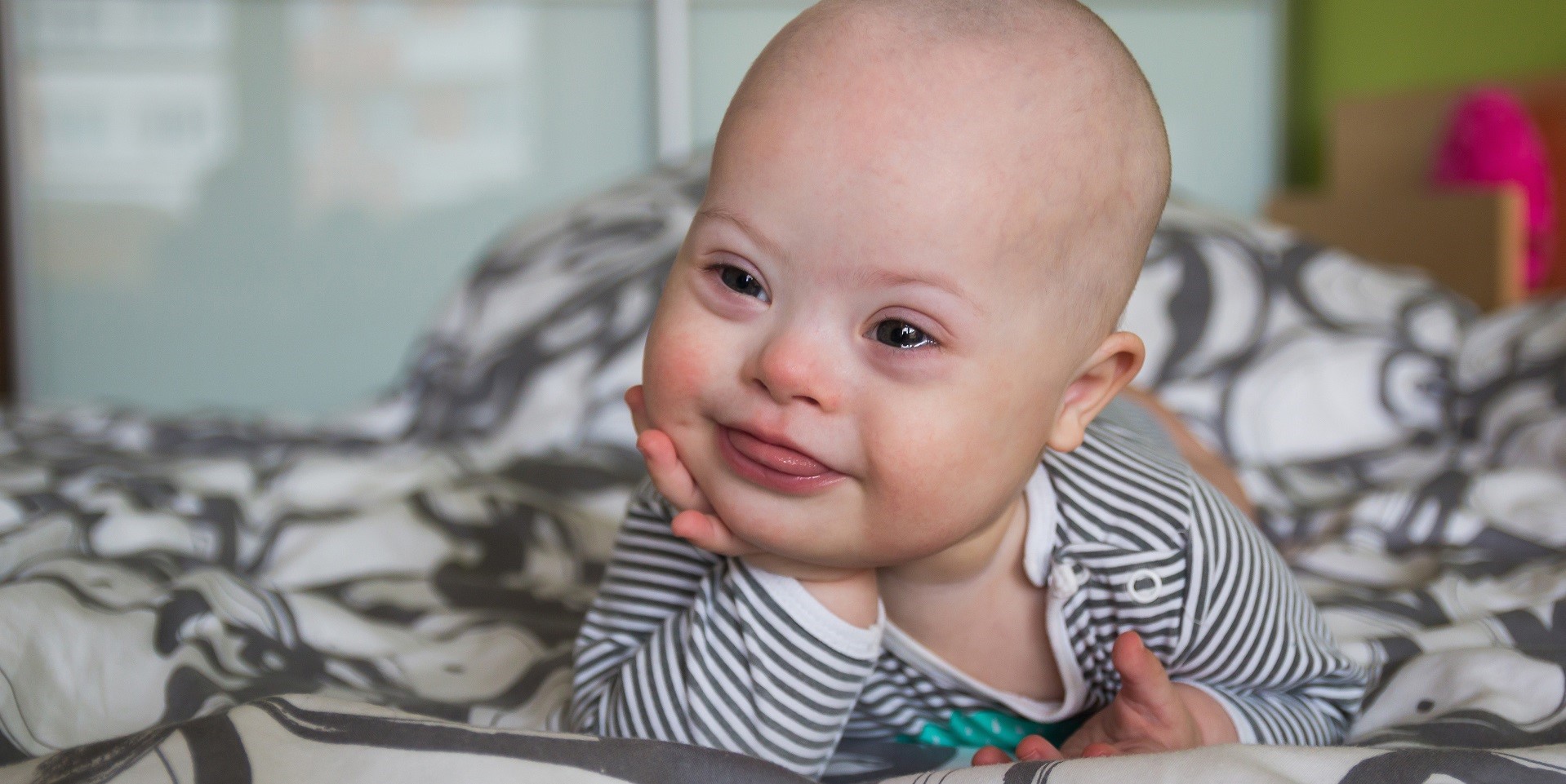 Baby down-syndroom iStock-655529734 1920x960px